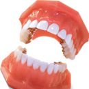 矯正歯科の画像