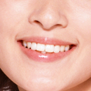 審美歯科の画像